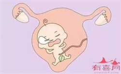 辽宁助孕优惠,[衡阳试管婴儿]试管婴儿移植后注意事项